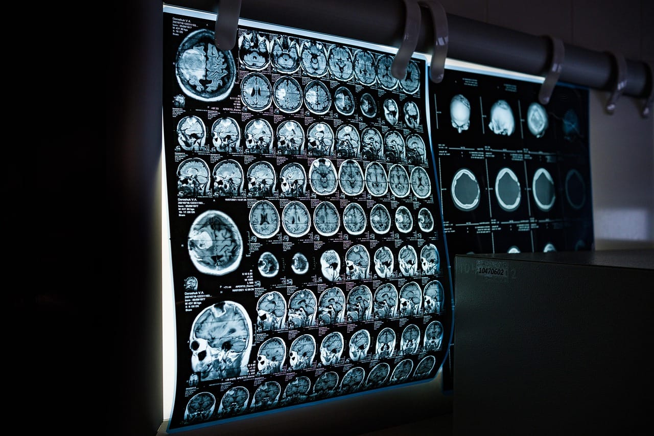 Regulação de Large Language Models (LLMs) no Brasil 1 x-ray, mri, ct scan, computed tomography, magnetic resonance imaging, medicine,