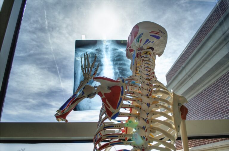 skeleton, medical, technology, medicine, tools, x-ray, skeleton, skeleton, skele