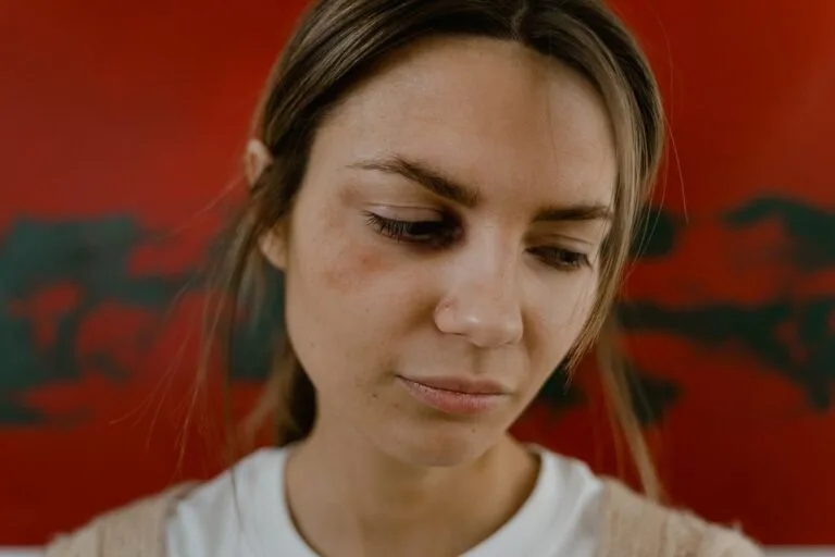 Close-up of a woman with a bruised eye looking down, set against a red background.