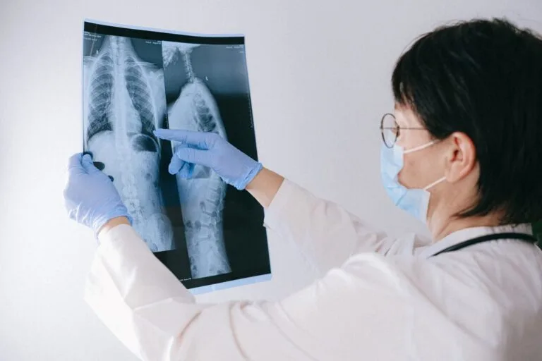 Perícia do INSS para Problemas de Coluna: Como Se Preparar 4 Medical professional reviewing an X-ray, emphasizing healthcare diagnosis and examination.
